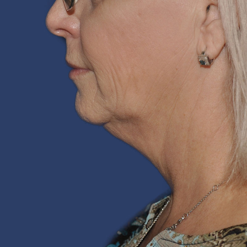 bna image b