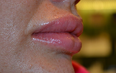 bna image