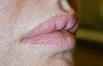  bna image b