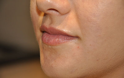  bna image b