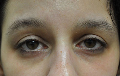 Patient 3 before photo