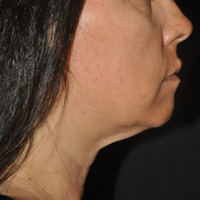 bna image