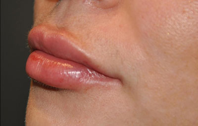 bna image