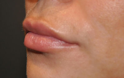  bna image b