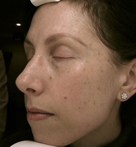 Patient 7 before photo