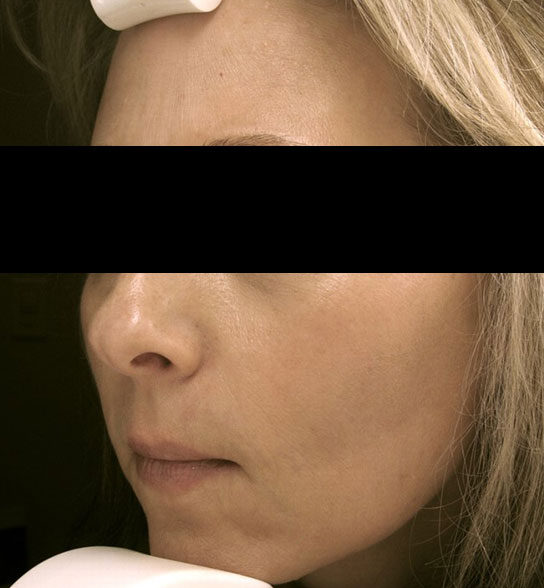 Patient 6 after photo