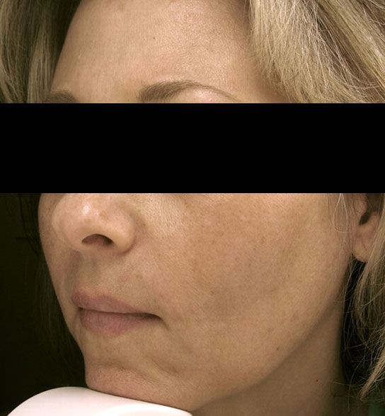 Patient 6 before photo