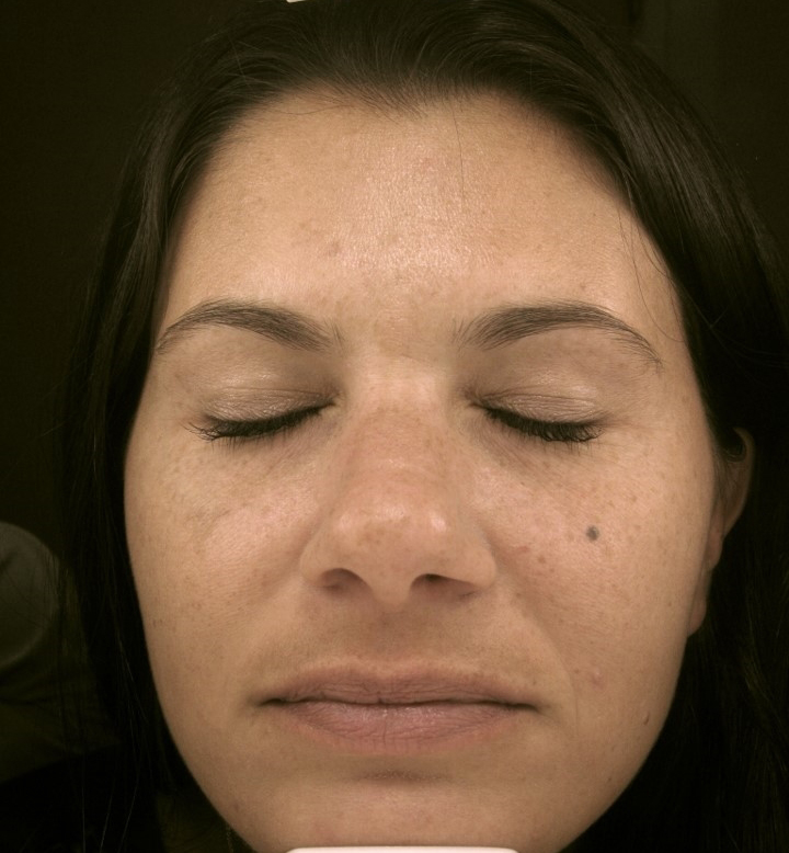 Patient 4 before photo