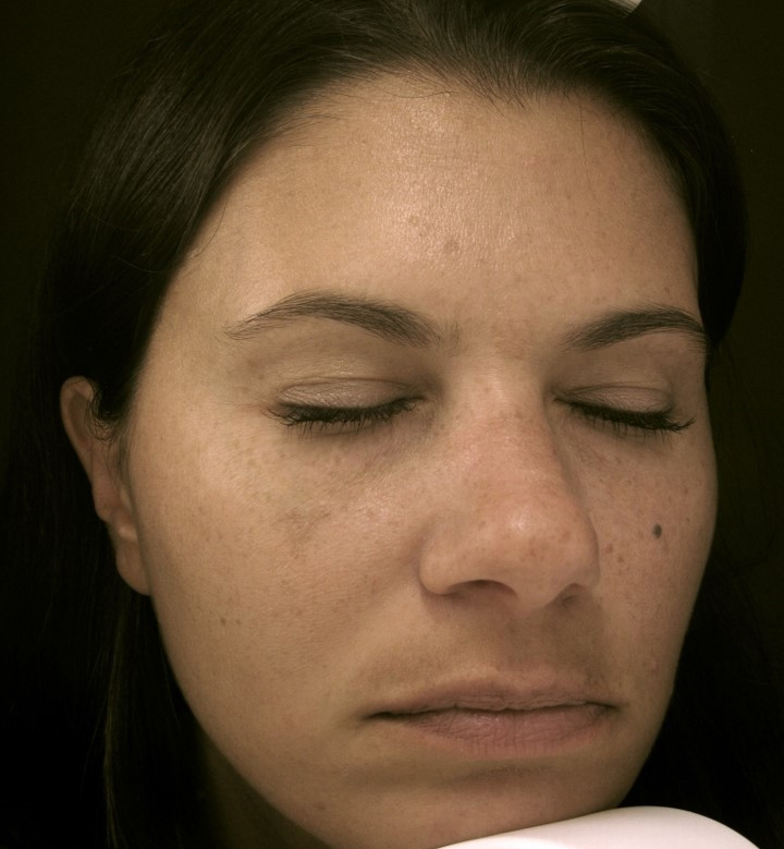  bna image b