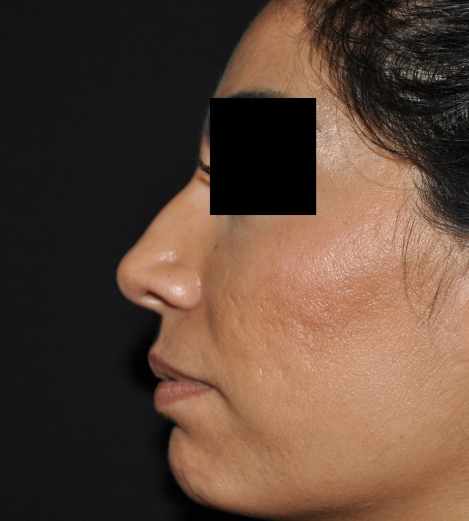 Patient 5 before photo