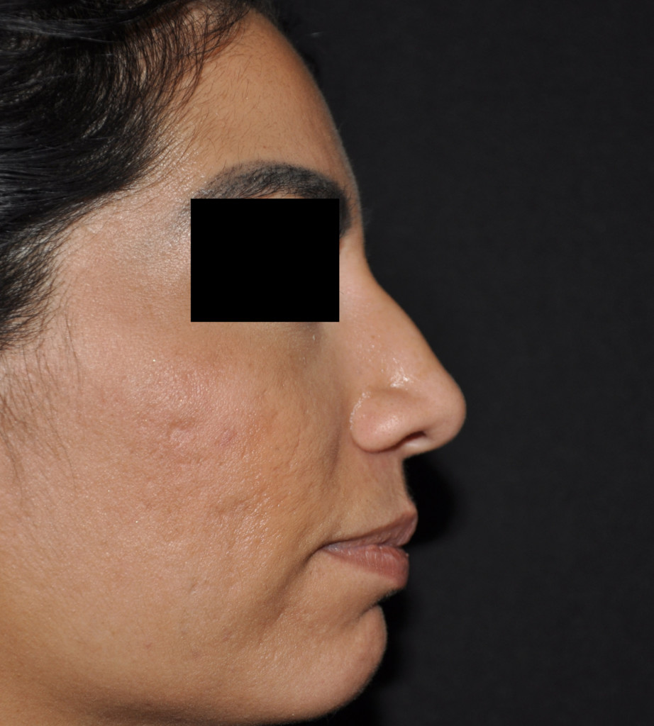  bna image b