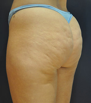  bna image b