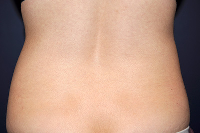  bna image b
