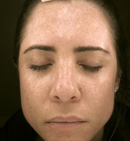 Patient 3 before photo
