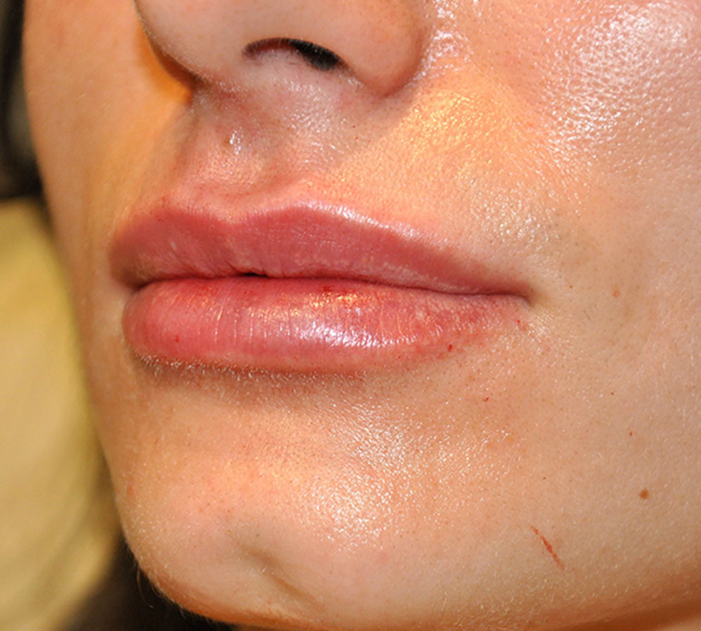 bna image
