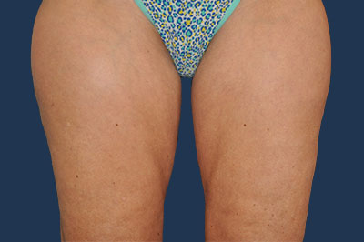 bna image