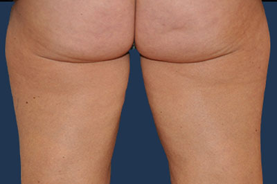 bna image