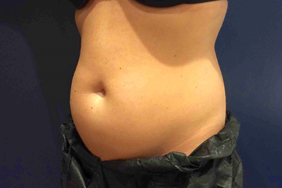  bna image b