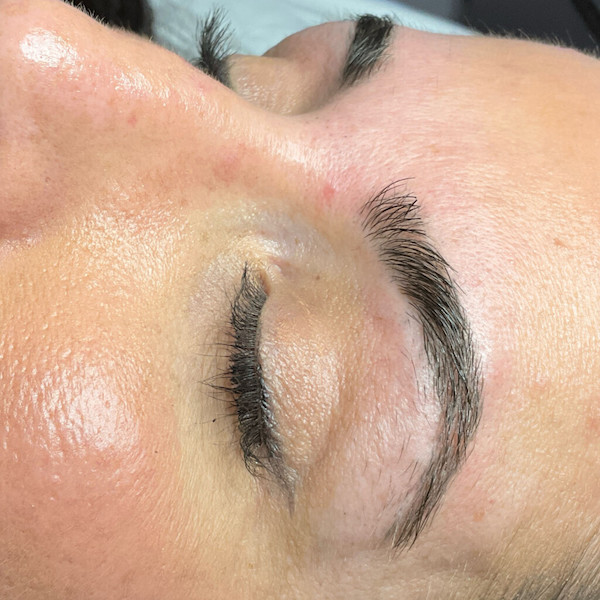 Patient 4 before photo